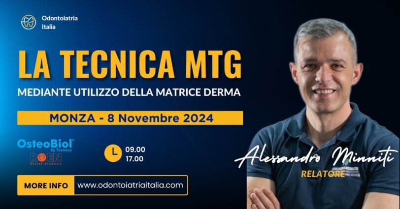 La tecnica MTG - Monza | dott. Alessandro Minniti | Odontoiatria Italia