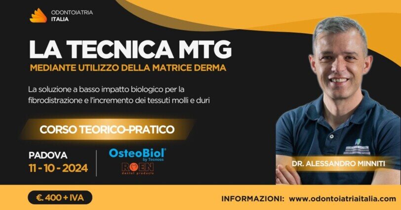 La tecnica MTG | dott. Alessandro Minniti | Odontoiatria Italia